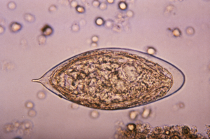 Schistosoma parasite